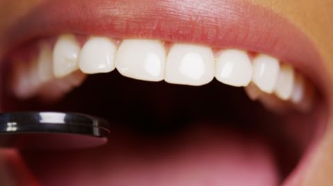 Peach Valley Dental photo